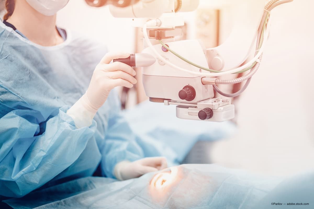LASIK surgery being performed on a patient 