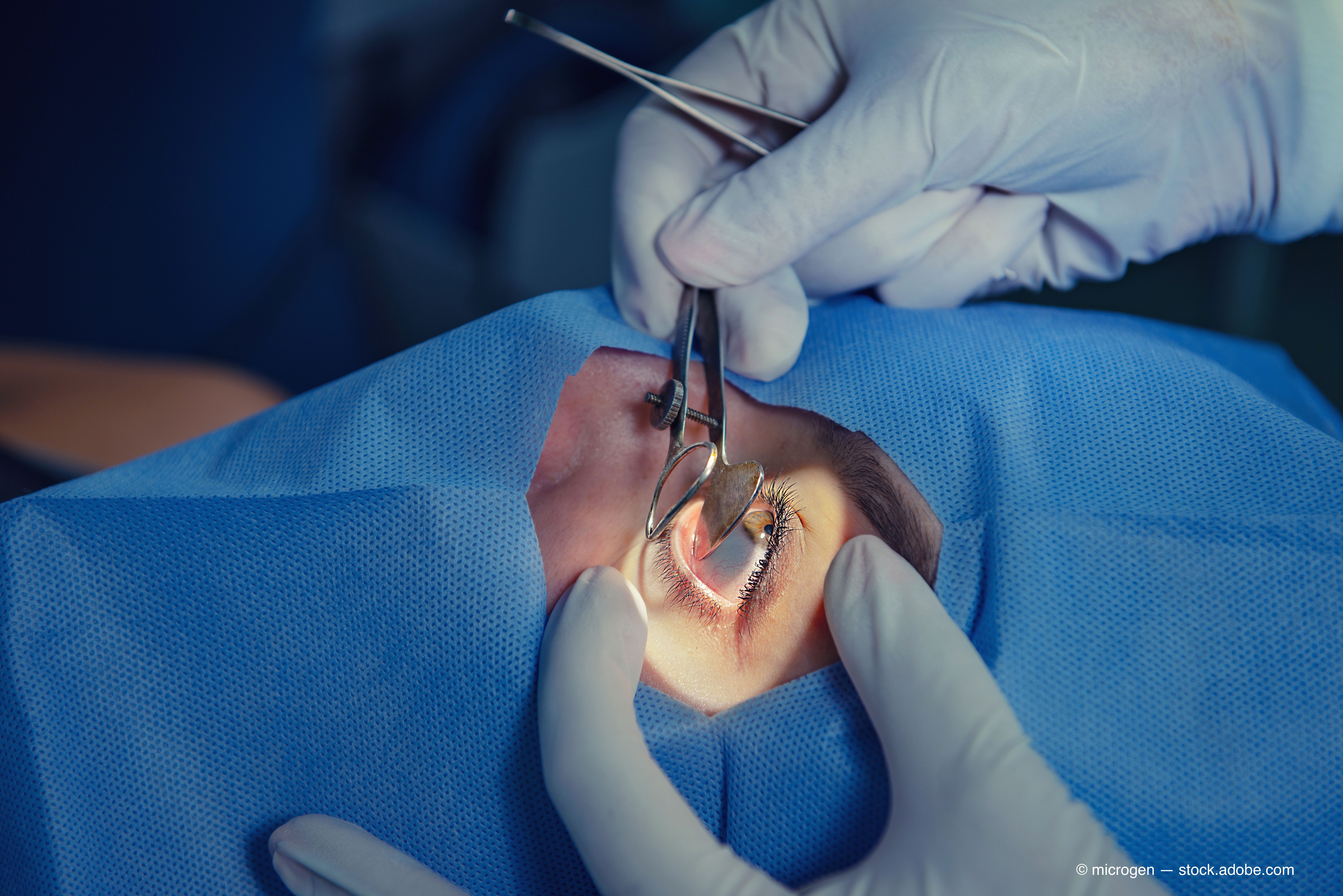 SURGERY 