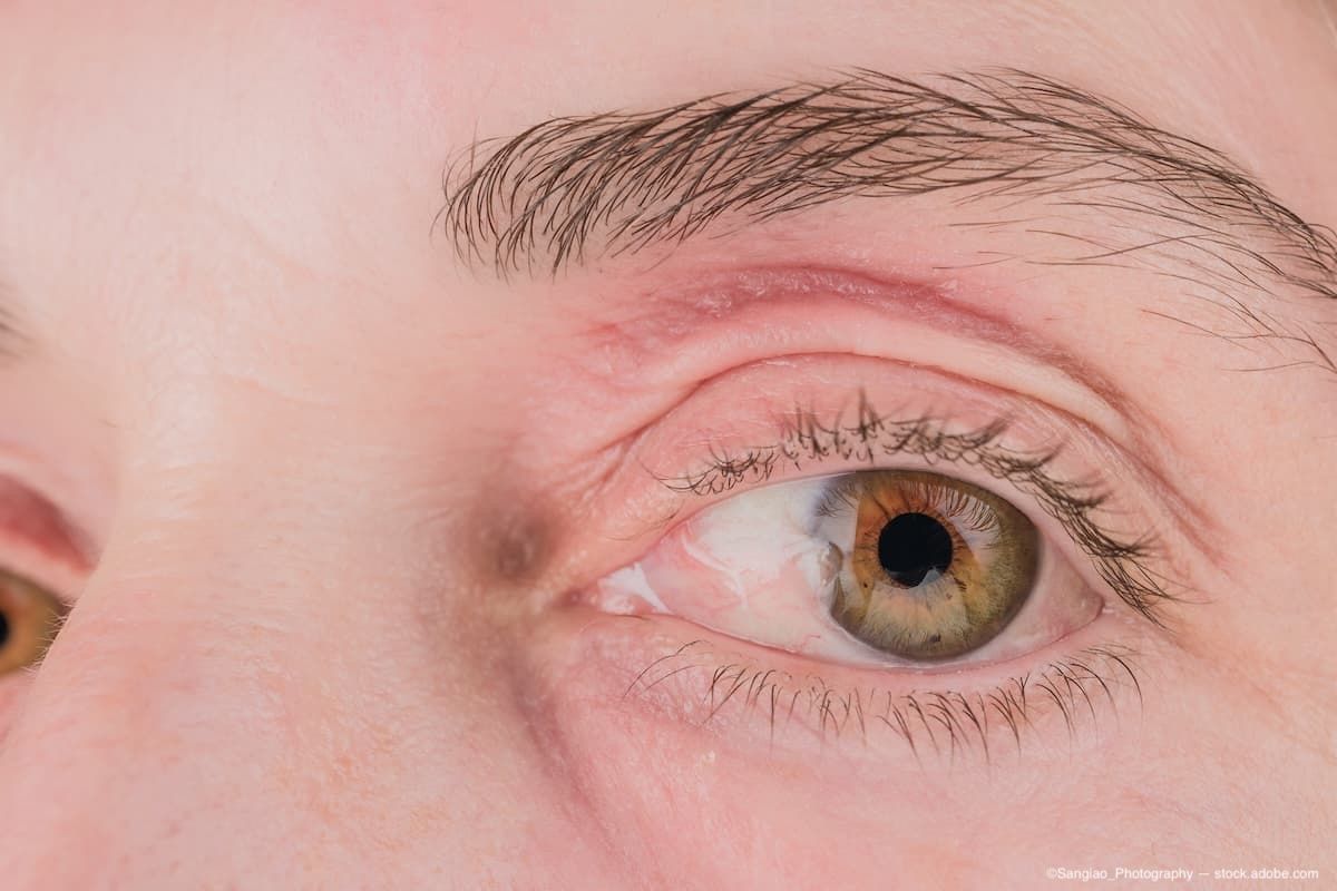 (Image Credit: AdobeStock/Sangiao_Photography)