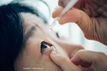 Optimizing the ocular surface in cataract surgery patients 