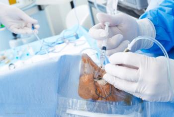 Real-world experience with dexamethasone intraocular suspension in cataract surgery