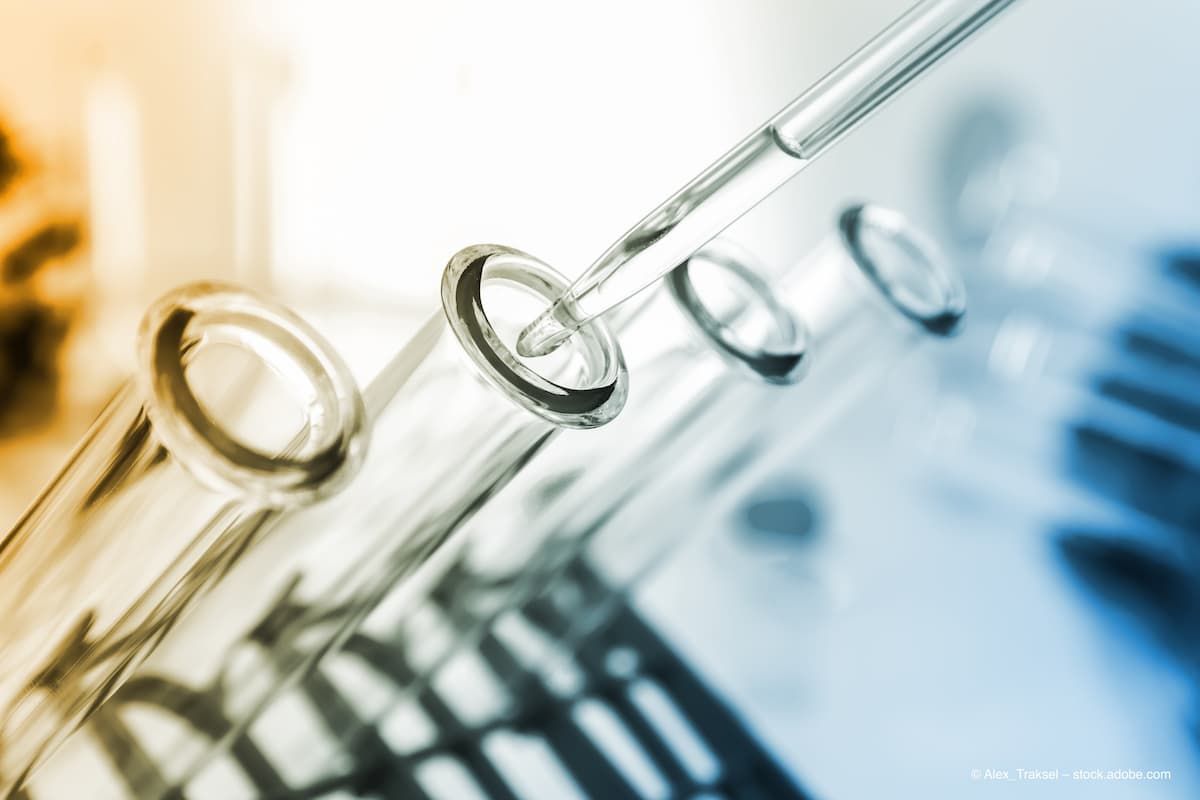 pipette and test tube on coloured background (Image credit: ©Alex_Traksel/AdobeStock) pipette and test tube on coloured background (Image credit: ©Alex_Traksel/AdobeStock)