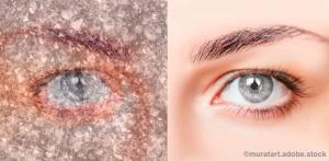 Reeling in the shark: How to take the fear out of dry eye diagnosis and treatment