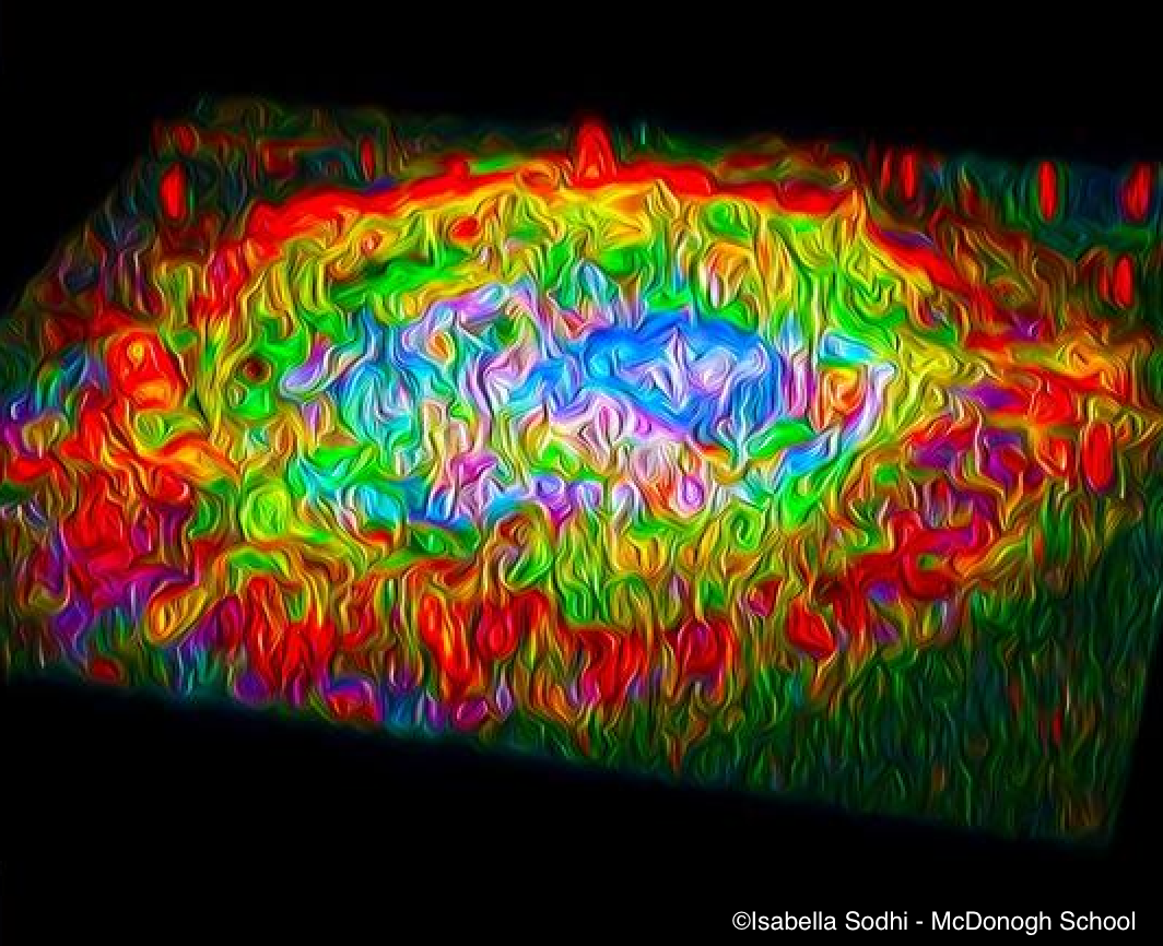 Researchers offer insights into wet AMD: Study reveals potential to enhance anti-VEGF therapy with experimental drug to preserve vision