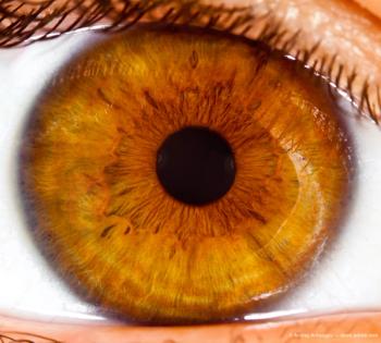 DME diagnosis plays no role in determining whether patients will receive injection.