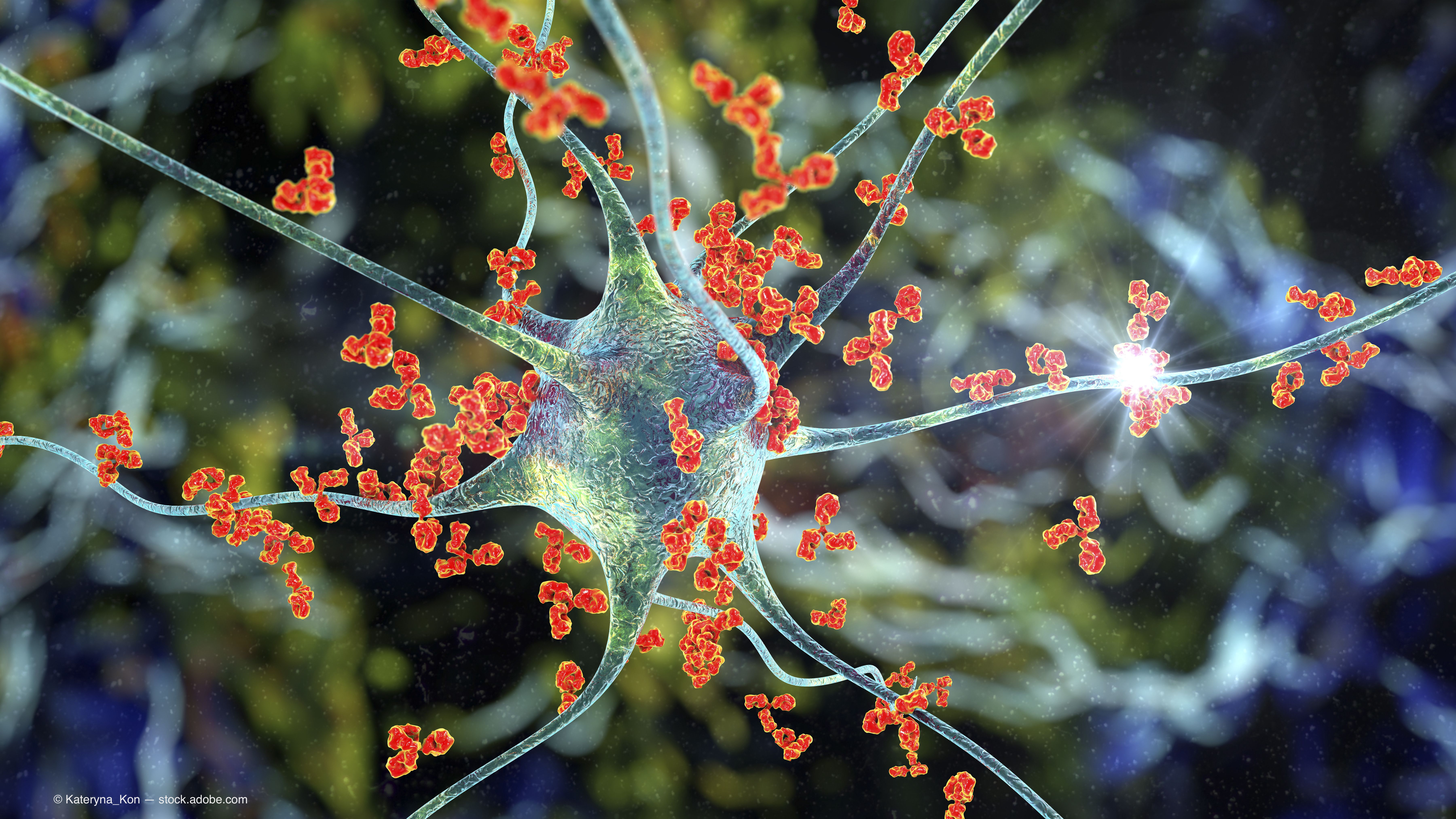 AAV gene therapy targets autoimmune uveitis