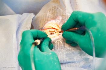 Ophthalmologist outlines his journey with the procedure as a late adopter.