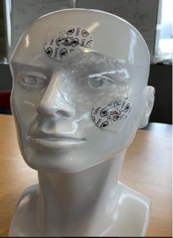 (Courtesy of Joshua Mali, MD, FASRS) (Courtesy of Joshua Mali, MD, FASRS)