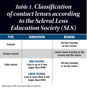 Managing irregular cornea with scleral contact lenses