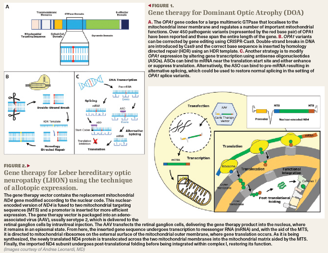 Exploring Developments In Gene Therapy For Inherited Optic Neuropathies