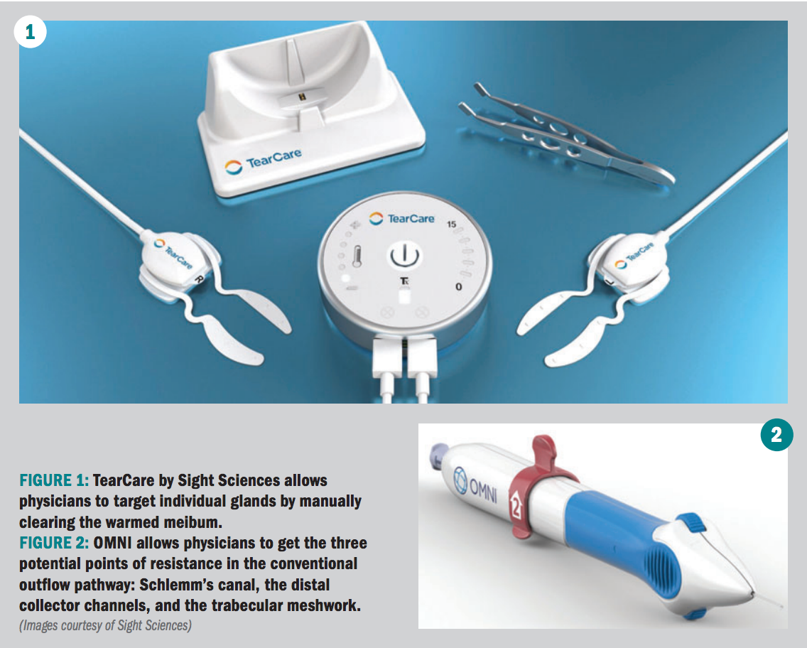 Sight Sciences device technology 