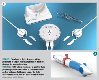 Sight Sciences device technology 