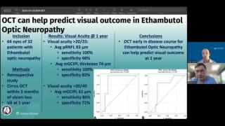 (Image credit: Ophthalmology Times) NeuroOp Guru: Using OCT to forecast outcomes in ethambutol optic neuropathy