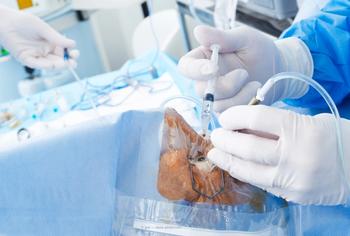 Study: Bimatoprost implant reduces IOP for 2 years or more