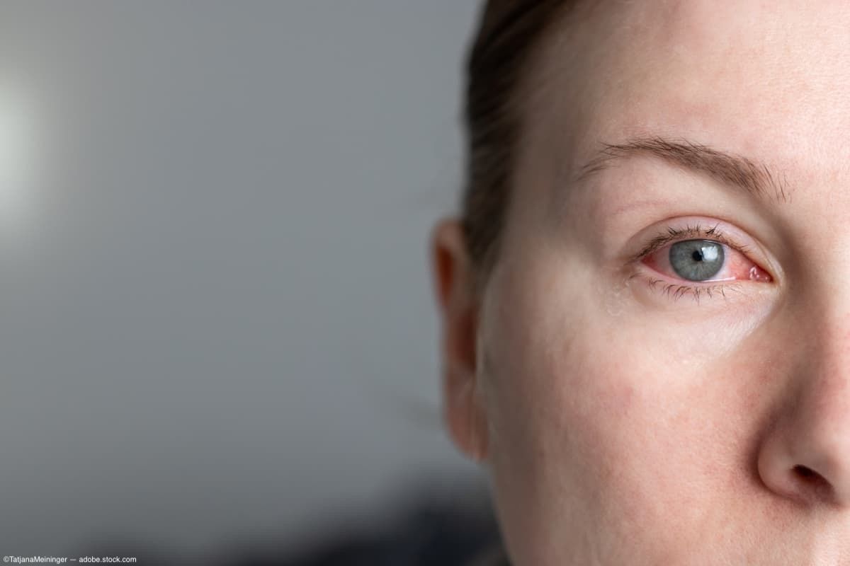 Ocular or orbital trauma associated with increased risk of mortality in victims of intimate partner violence