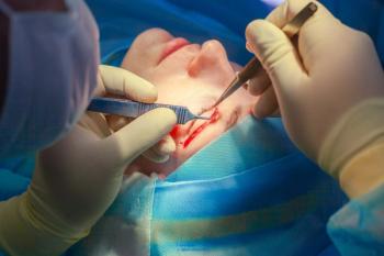 Researchers led by Liza Cohen, MD, from the Division of Orbital and Ophthalmic Plastic Surgery, Stein Eye Institute, Doheny Eye Institute, Los Angeles, reported that development of involutional ptosis may be a multifactorial process.