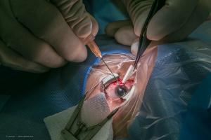 Multiple presentations offer insight to cataract surgeons about the ocular surface and outflow in glaucoma surgery