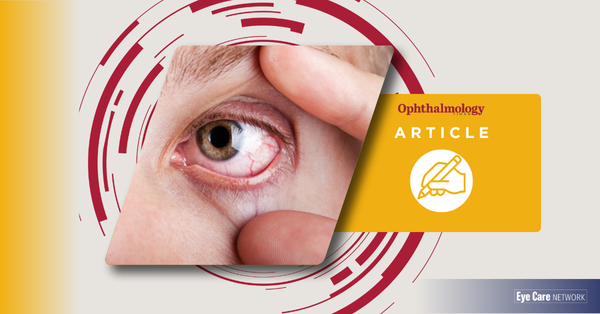 (Ophthalmology Times) Pterygium width may help predict corneal optical disturbance