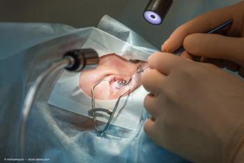 lasik eye surgery