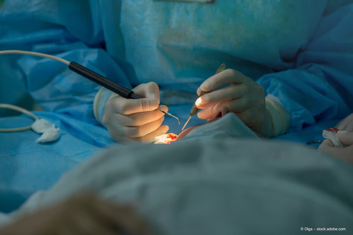 Operative Technique Surgical Tissue