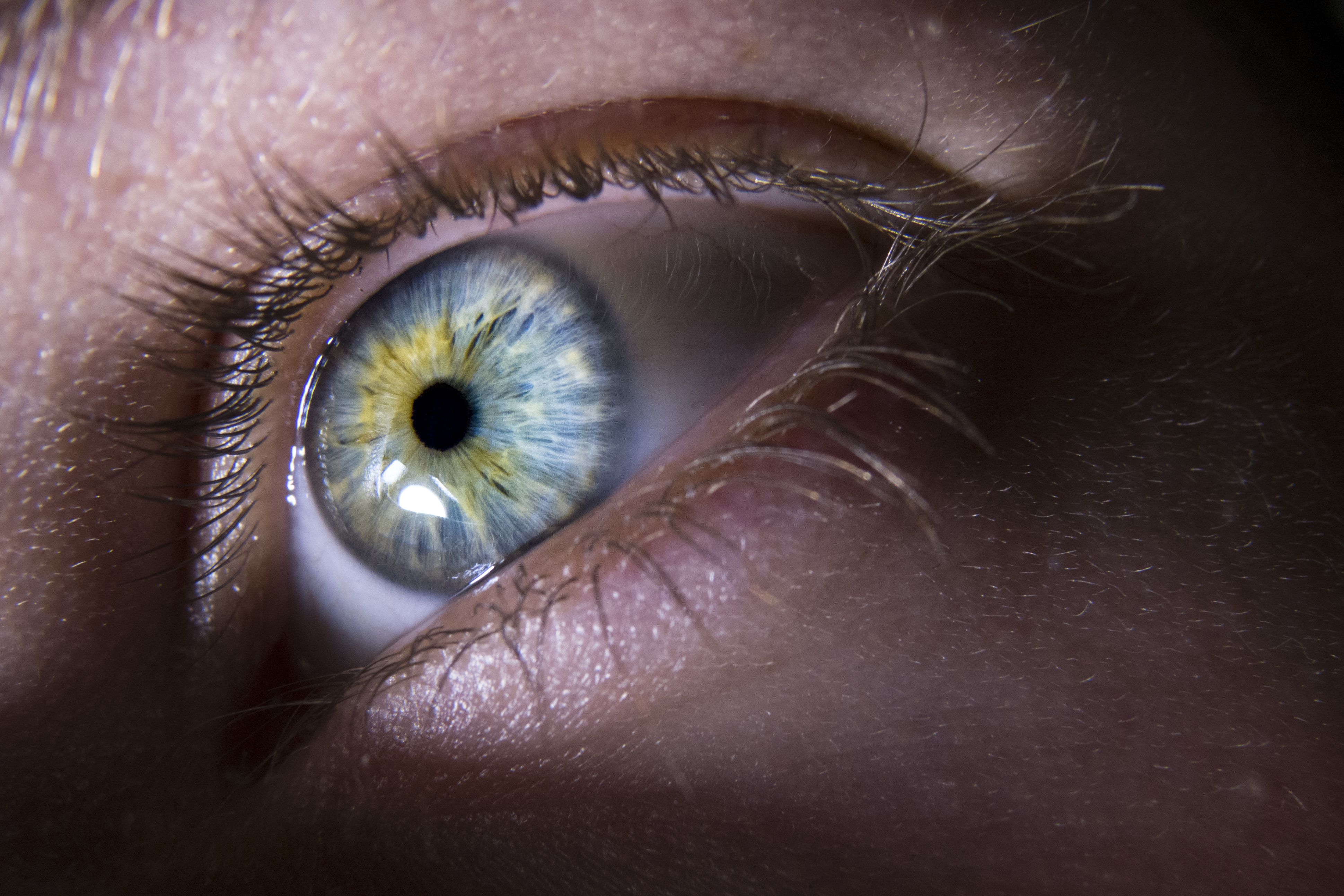 Blepharoptosis: Unraveling this not-so-simple disorder