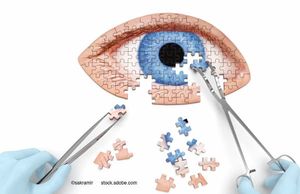 (Image credit: AdobeStock/sakramir) Q&A: Robert H. Osher, MD, on how VR is changing the cataract conversation