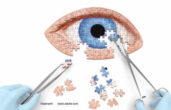 (Image credit: AdobeStock/sakramir) Q&A: Robert H. Osher, MD, on how VR is changing the cataract conversation