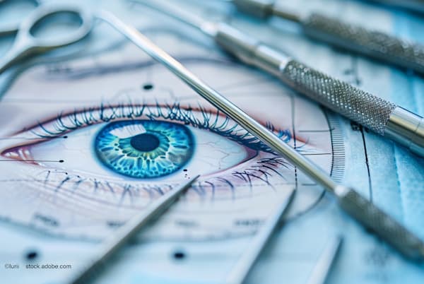 (Image credit: AdobeStock/Iurii) David Almeida, MD, MBA, PhD, advances ophthalmic training with near real surgical specimens at EyeCon 2025