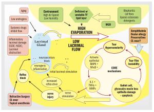 Detecting dry eye: What to keep, obtain, or omit