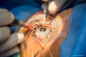 Depth-of-focus enhancement makes target easier to hit