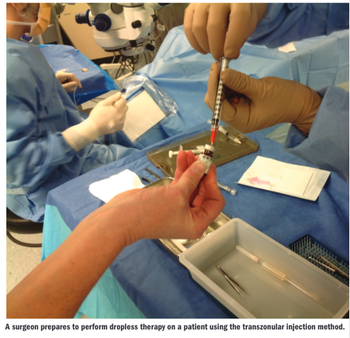 cataract surgery 