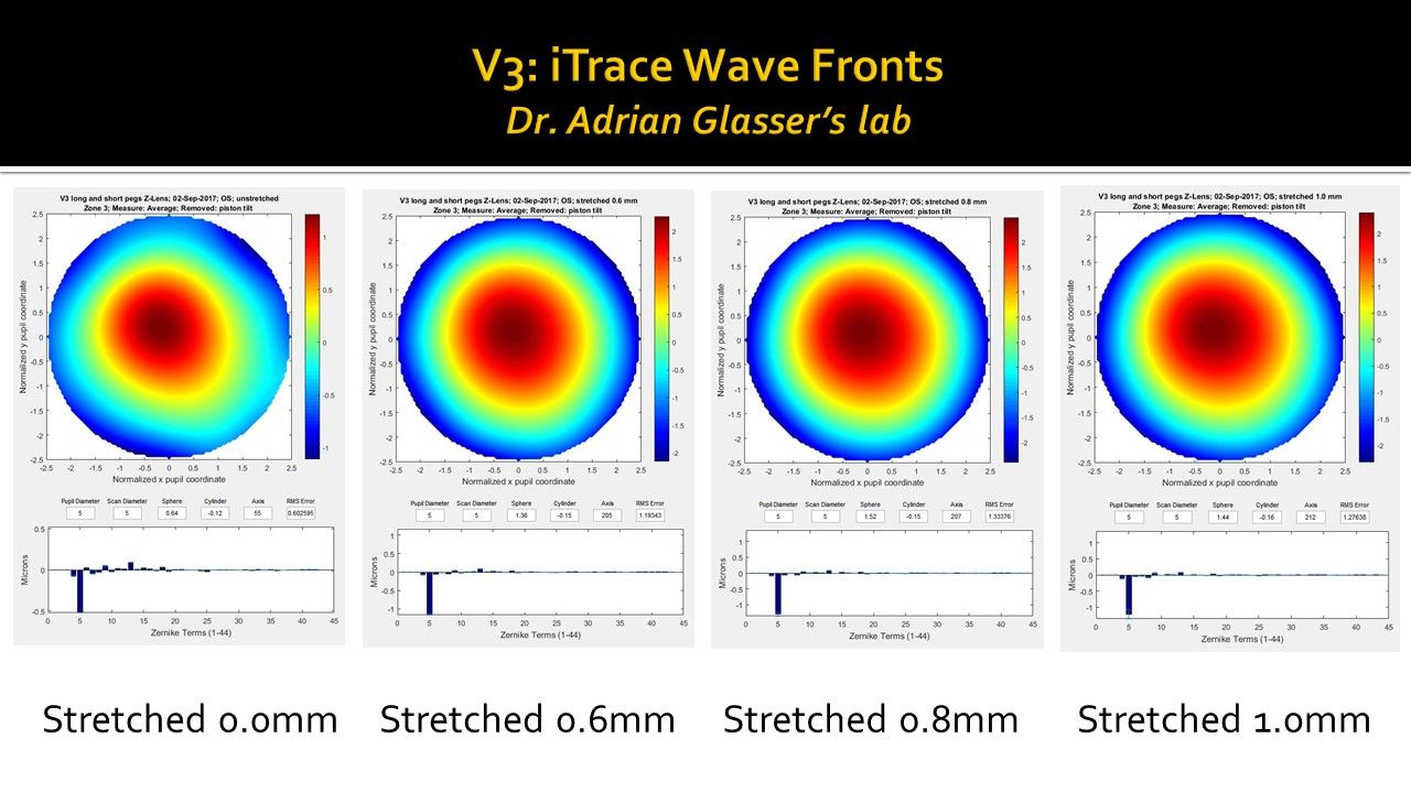 Novel accommodating IOL achieves unique level of accommodative change