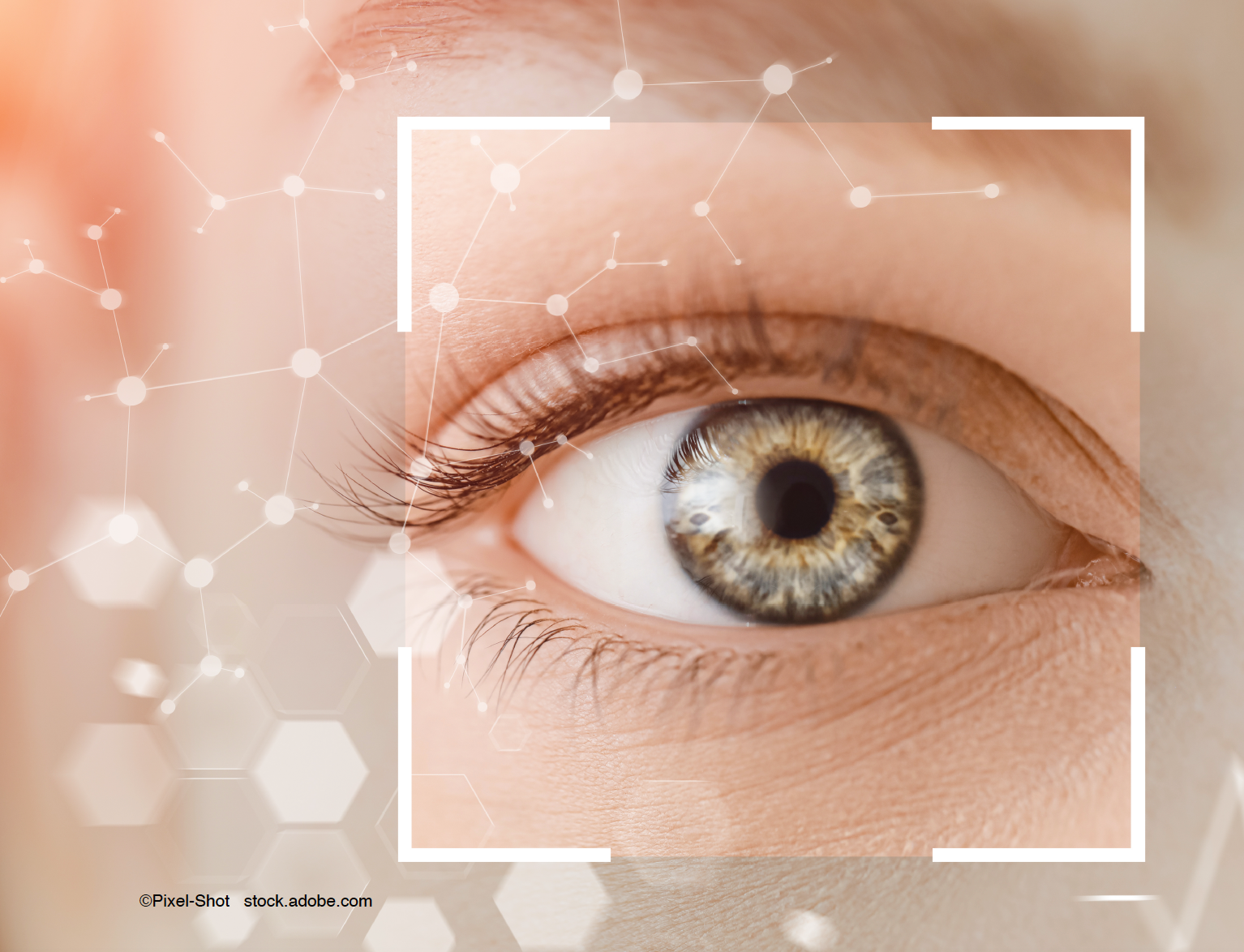 Novel therapeutic approach offers nonsurgical option for acquired blepharoptosis