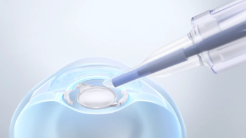 CT Lucia 621P | Image credit: ©ZEISS