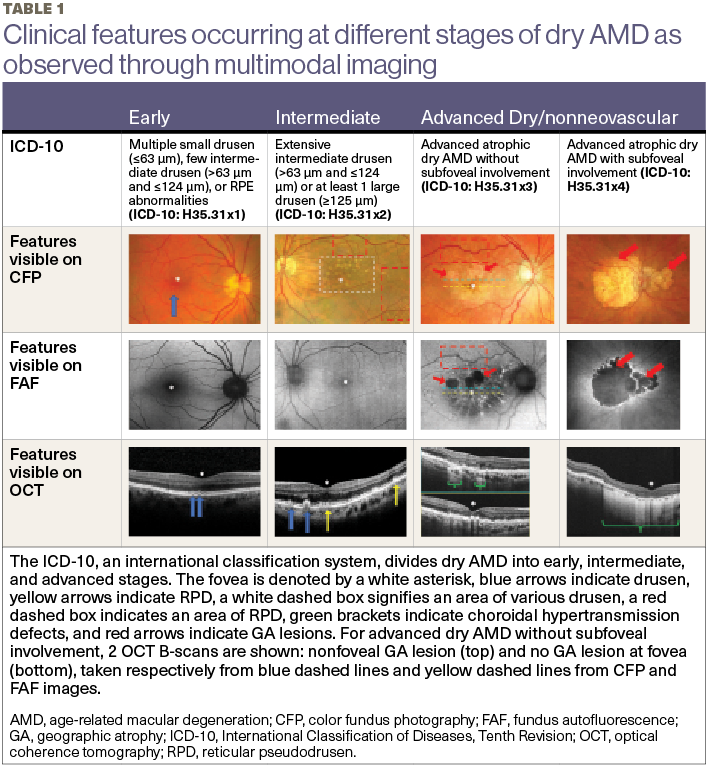 Amd Classification Eye Unlocking geographic atrophy