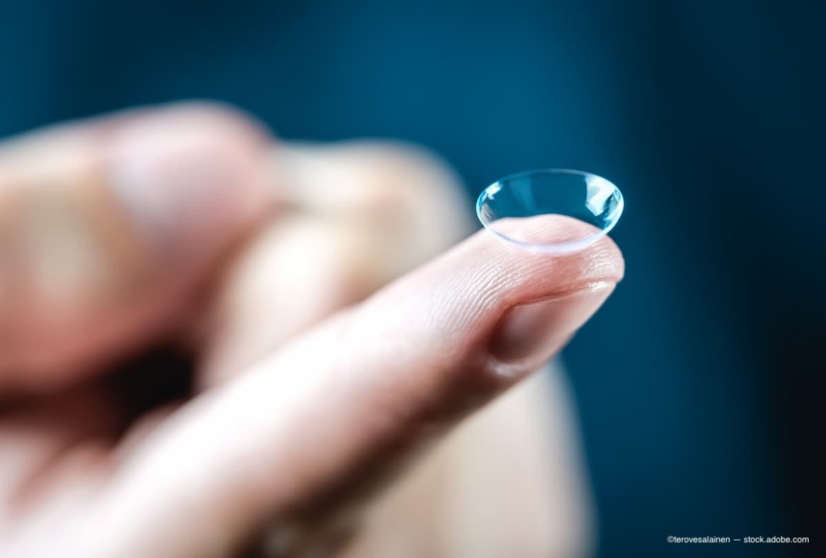 MediPrint Ophthalmics reveals positive results from phase 2b study of LL-BMT1 contact lens