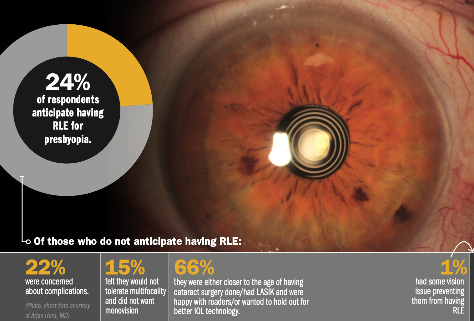 dispelling-myths-about-refractive-lens-exchange-ophthalmology-times