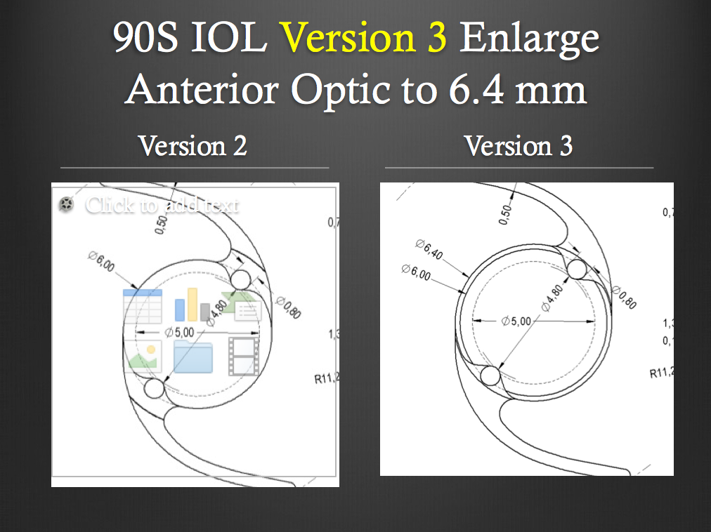 Novel IOL may be key to preventing negative dysphotopsia