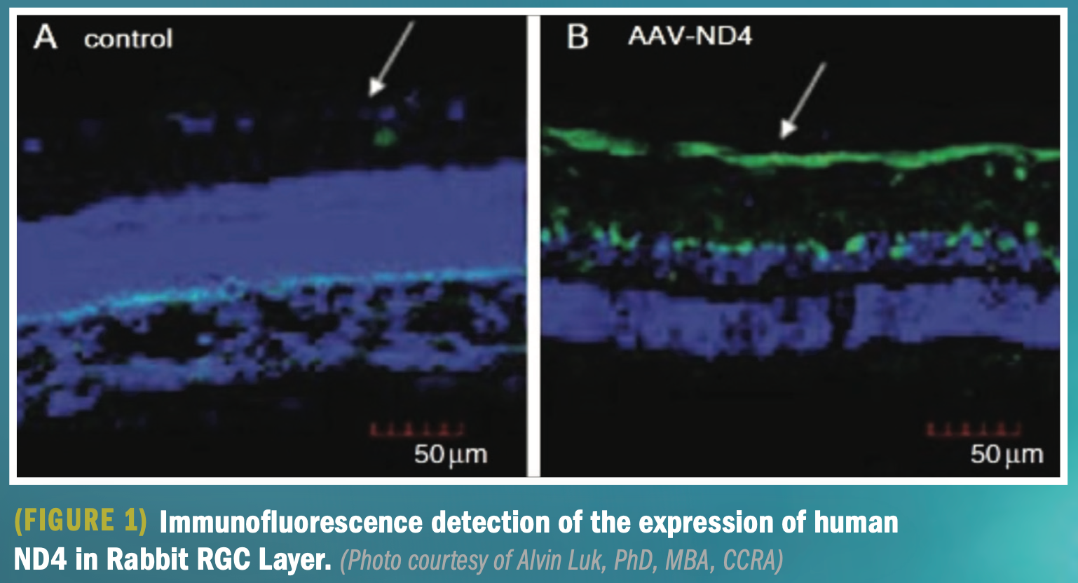 Research shows promising results for LHON gene therapy