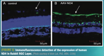 Research shows promising results for LHON gene therapy