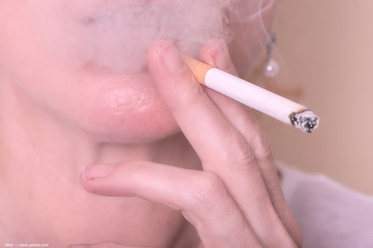 Study links secondhand smoke exposure to increased myopia risk in children