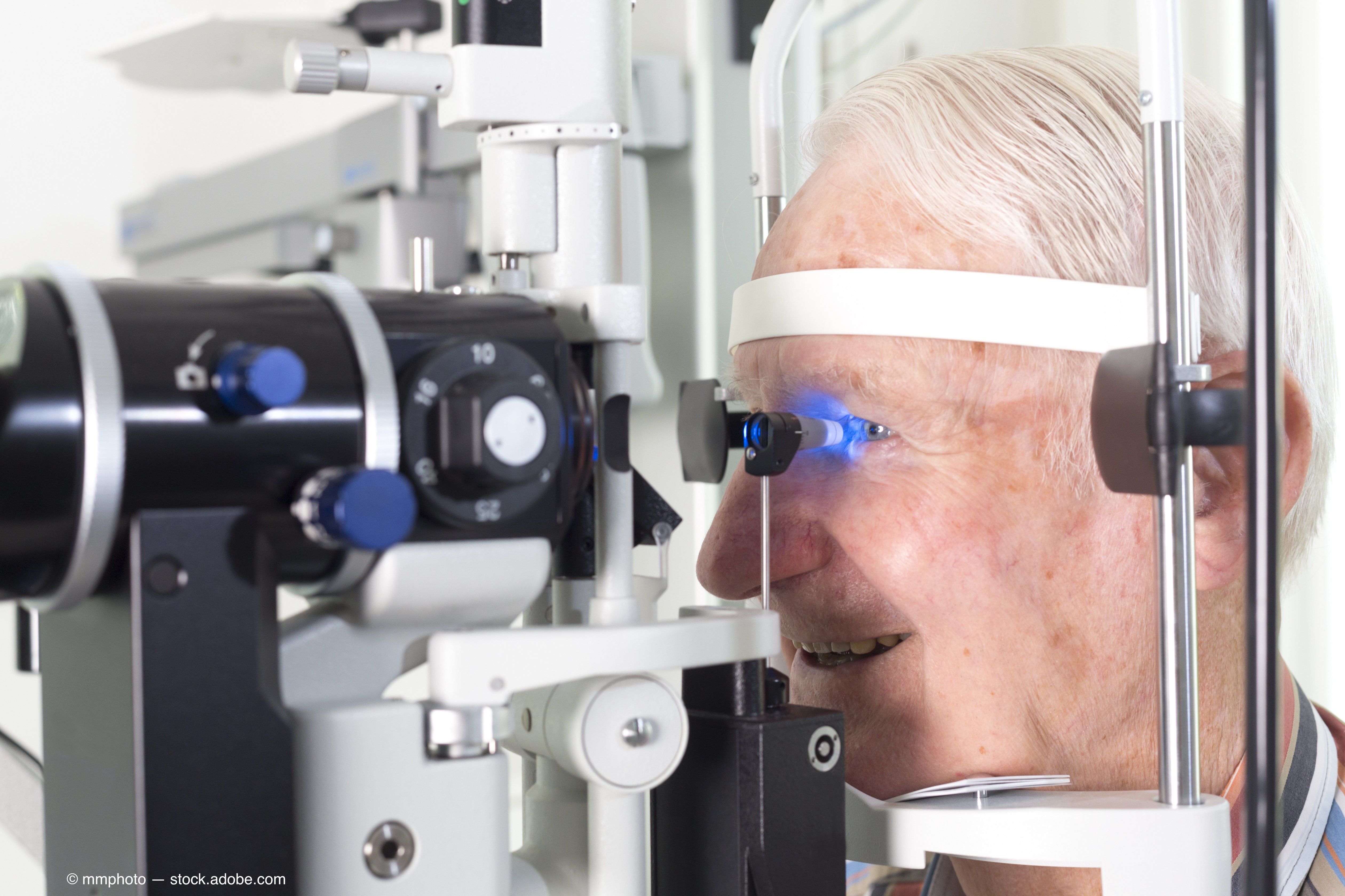 Можно вернуть зрение при глаукоме. Тонометрия Гольдмана. Исследование глаза. Исследование зрения.