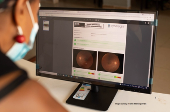 Artificial intelligence screenings improve eye care access in sub-Saharan Africa
