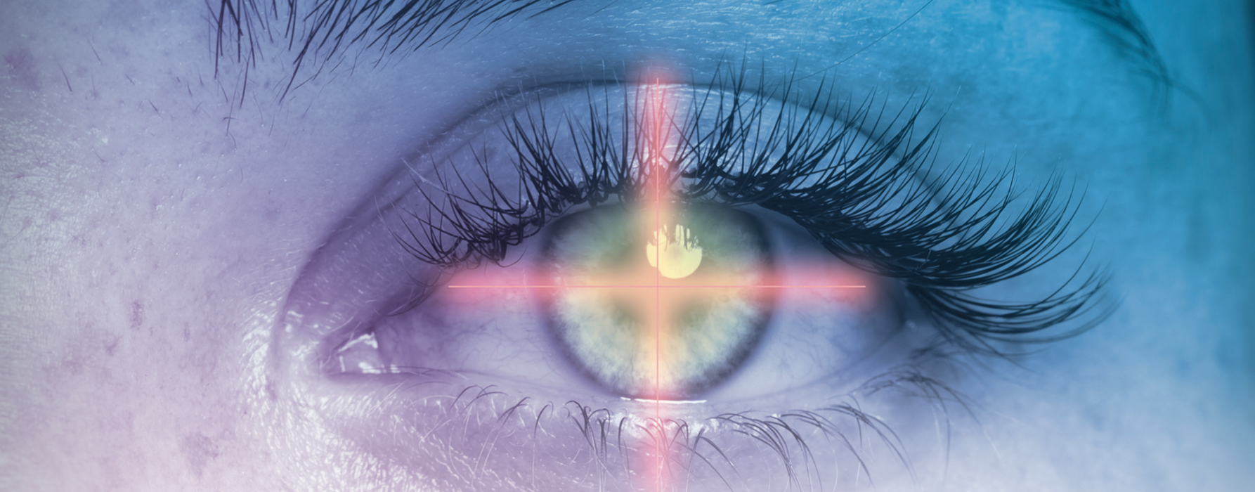 Collagen crosslinking provides corneal stability in young patients