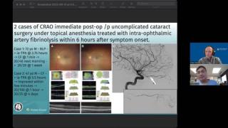 NeuroOp Guru: Two cases of CRAO occurring immediately postoperatively
