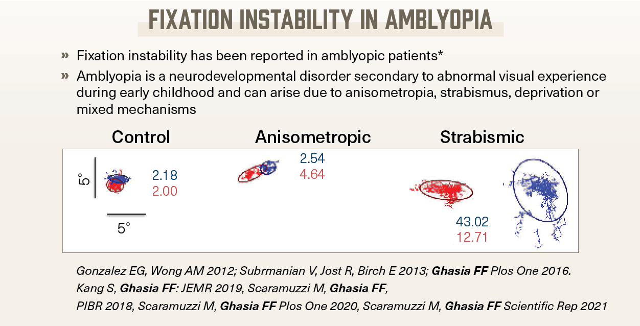 glutathione and amblyopia Pooled prevalence of based on countries. The reported Unraveling the mysteries of amblyopia