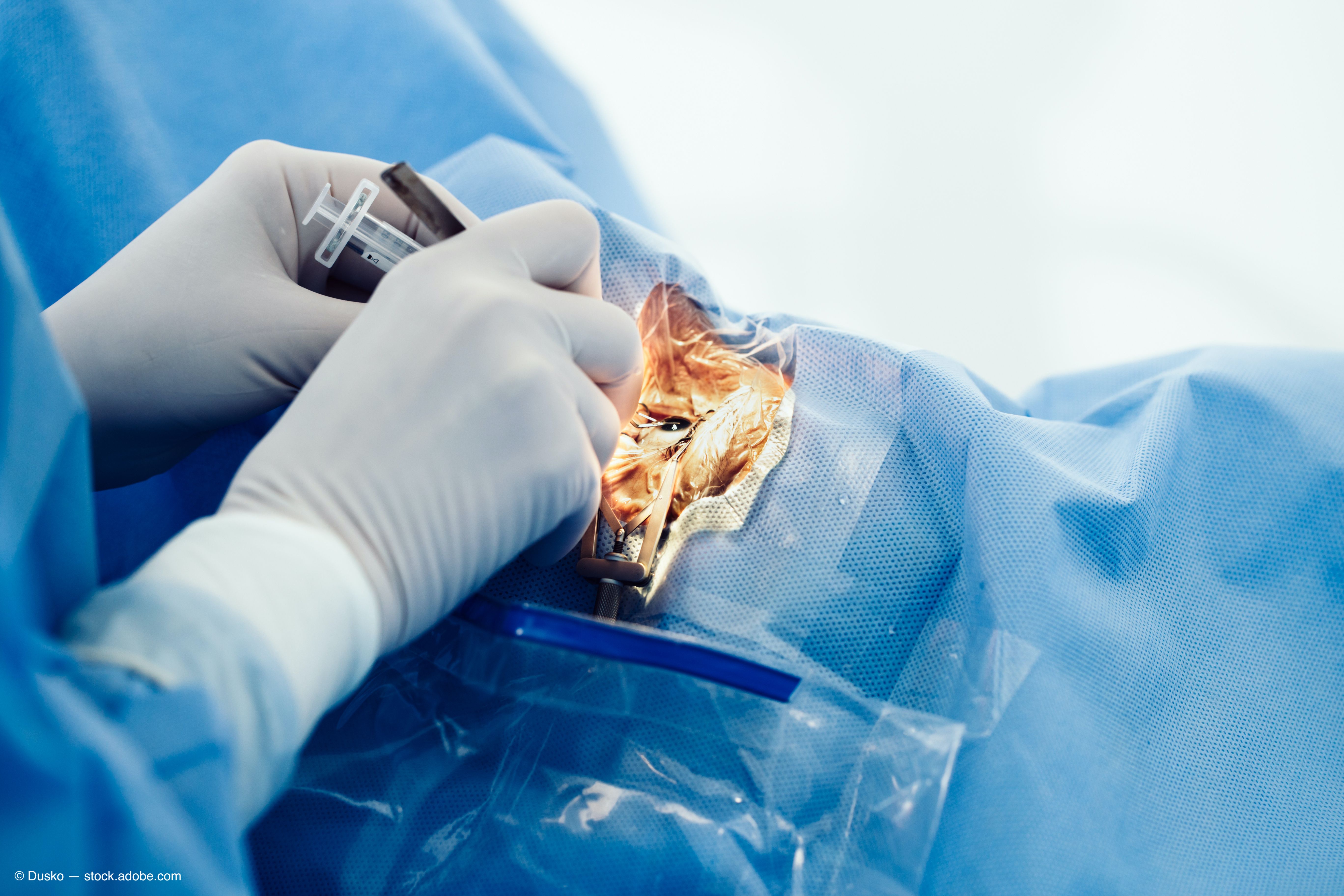 Retinal implant improves quality of life in patients with RP