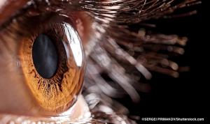 The importance of PERG in detecting early-stage glaucoma