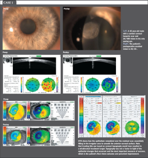 ETM valuable in planning, evaluation of outcomes