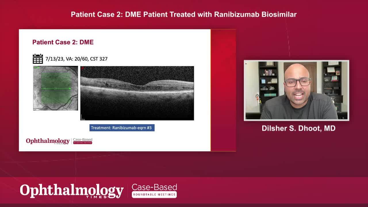 Patient case 2 DME Patient Treated with Biosimilar